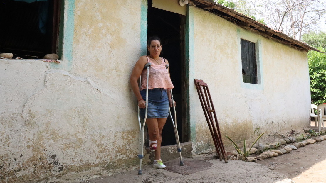 A woman stands leaning against the entrance to a cement house. She is leaning on crutches, her right leg amputated below the knee. 